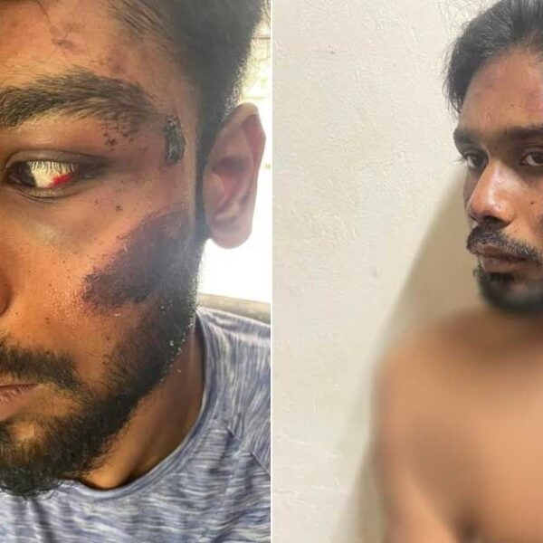 ‘ক্যাম্পাসে যেমন ইচ্ছা তেমন করব বলে সব জায়গায় পেটানো হয়’
