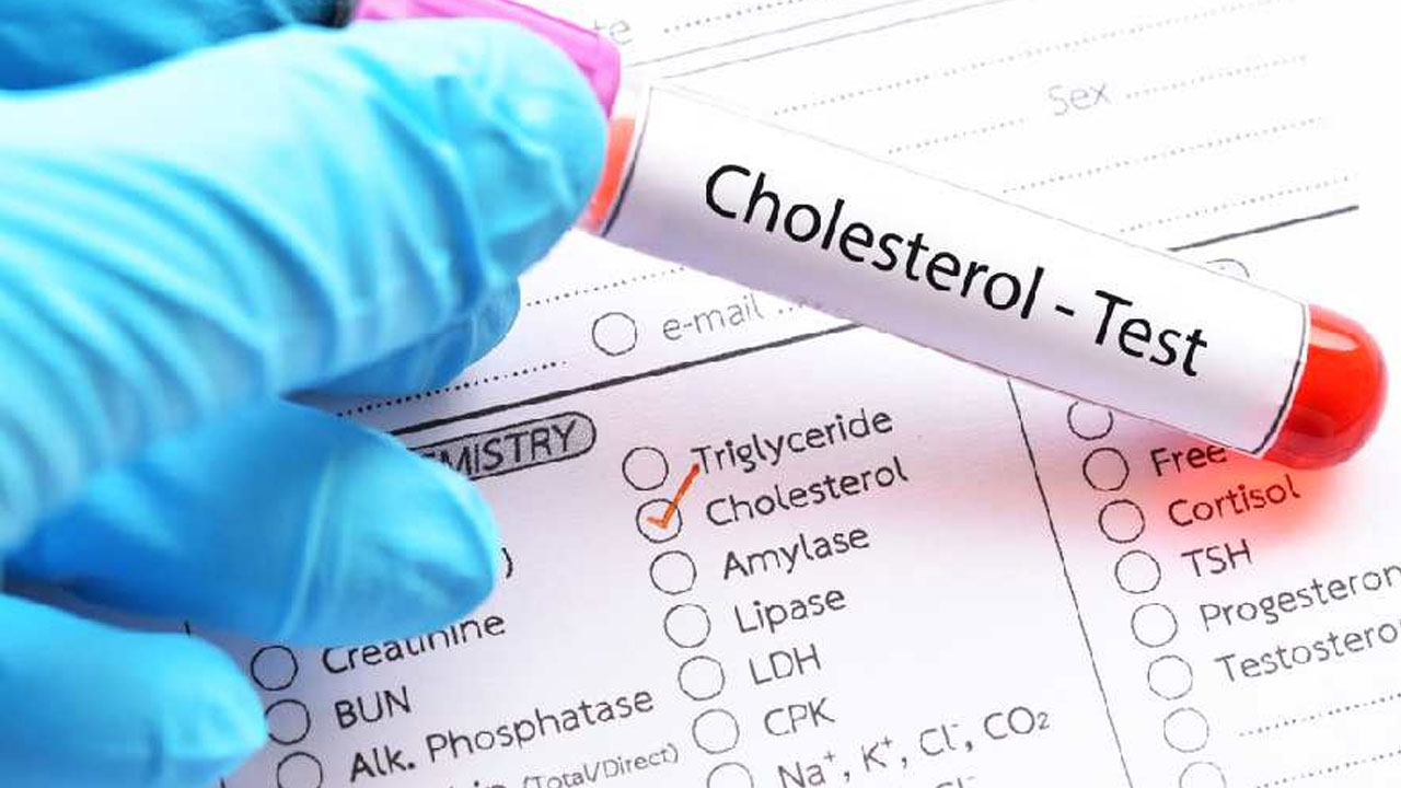 cholesterol 2024