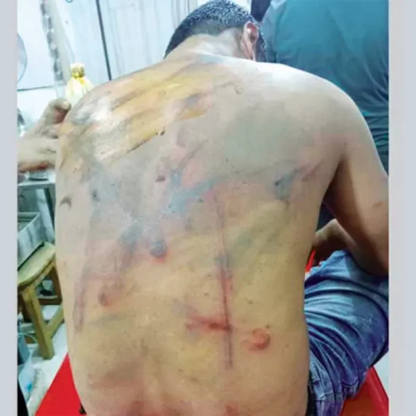 শিক্ষক আওয়ামী লীগ করতেন, তাই পি*টিয়ে স্কুলছাড়া করলেন যুবদল নেতা