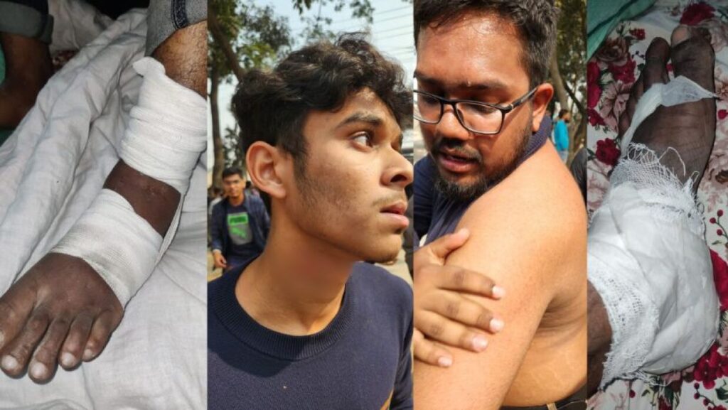 জাতীয় বিশ্ববিদ্যালয় শিক্ষার্থীদের আন্দোলনে হামলা, নারীসহ আহত ১০